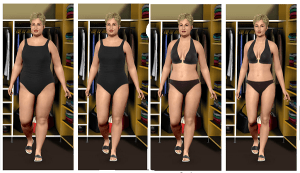 justdoit1 After Surgery and One Year Maybe